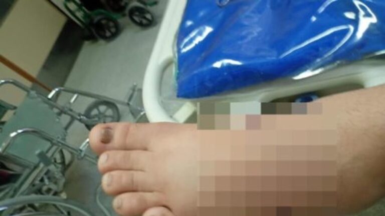 Un hombre les disparó a menores tras una fiesta e hirió a uno