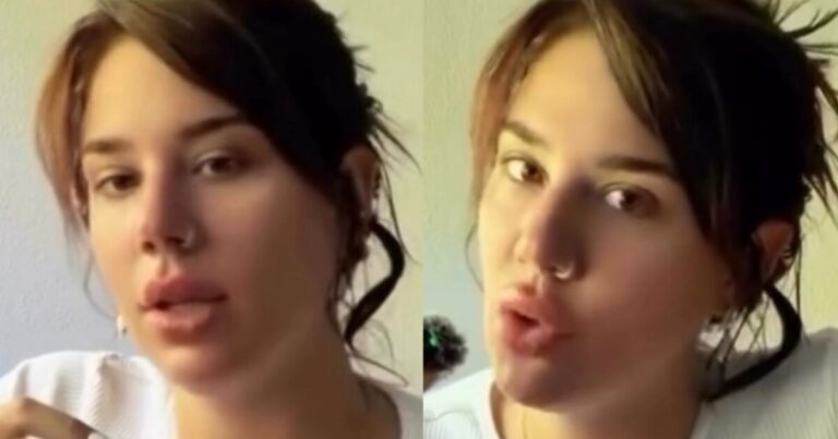 La Tora contó por qué se operó las lolas y confesó la propuesta fuerte que le hicieron: Me daban 6 mil dólares